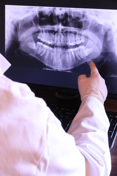 Best Emergency Gum Treatment in Miami Springs, FL